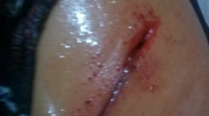 VICTORICA: PERROS ATACAN A MUJER