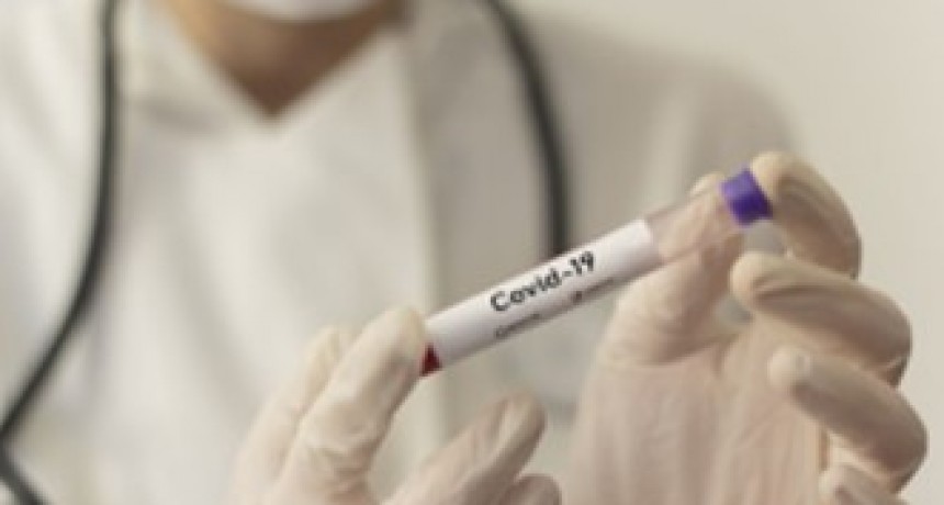 ANALISIS DE CORONAVIRUS: LOS DOS DIERON NEGATIVO