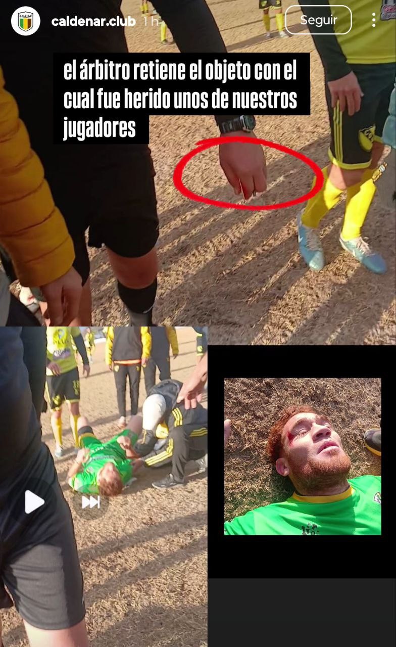AGREDEN A JUGADOR DE EL CALDENAR FRENTE A URIBURU (mirá)