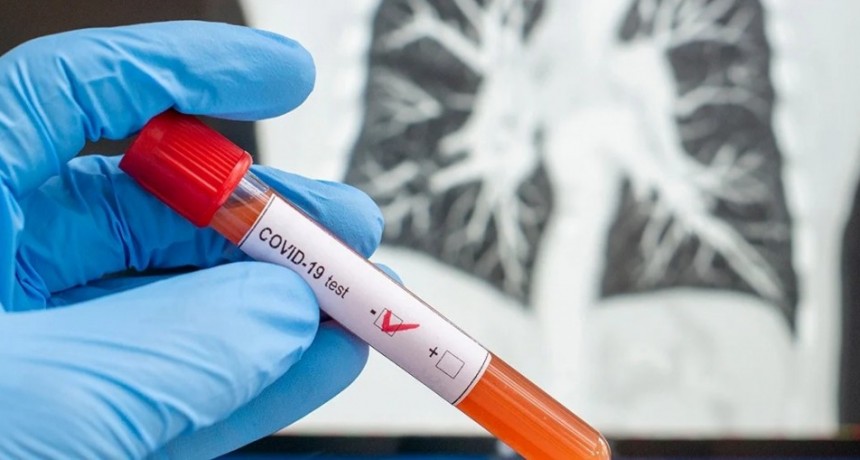 Las 8 localidades de La Pampa donde hay casos de coronavirus