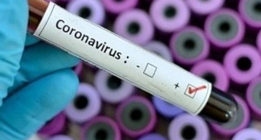 Coronavirus en La Pampa: 4 nuevos casos, 3 son de General Pico