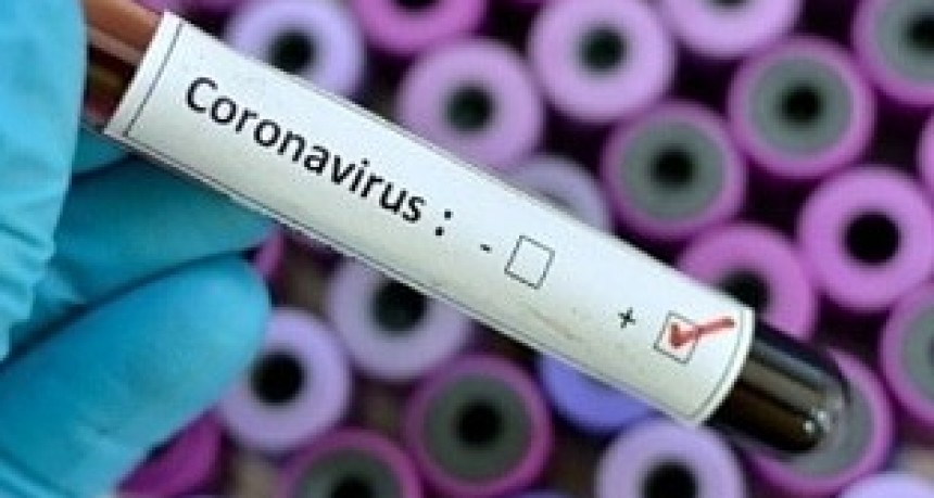 VICTORICA CON 7 NUEVOS CASOS LLEGO A 16 POSITIVOS DE COVID 19