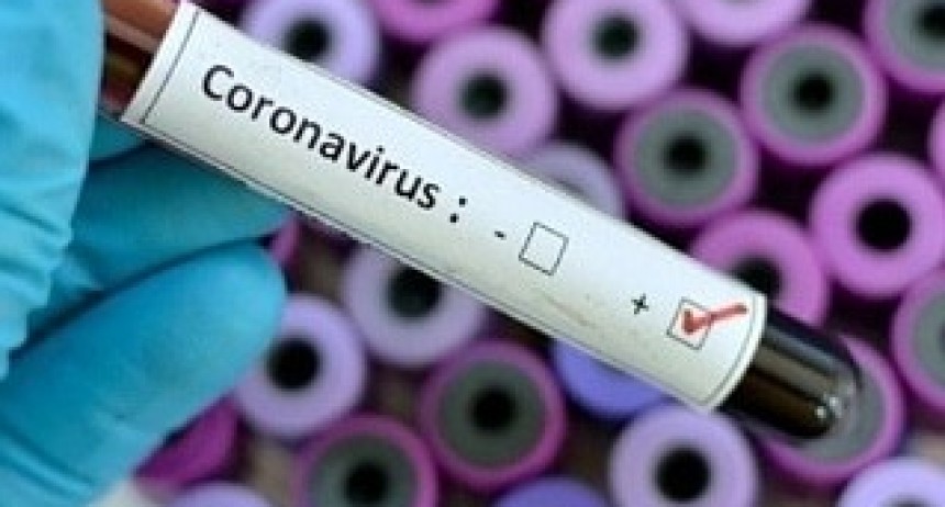 COVID-19: TRES NUEVOS CASOS Y AHORA SON 21 POSITIVOS EN VICTORICA