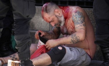 Impactantes imágenes de los incidentes en el Congreso